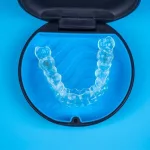 Clear Aligners
